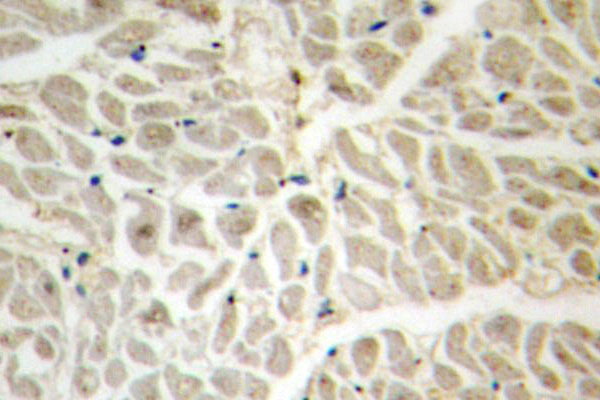 IHC of FoxD3 (R233) pAb in paraffin-embedded human heart tissue.