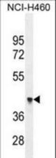 FX4L1 Antibody western blot of NCI-H460 cell line lysates (35 ug/lane). The FX4L1 antibody detected the FX4L1 protein (arrow).