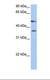 Hela cell lysate. Antibody concentration: 1.0 ug/ml. Gel concentration: 12%.