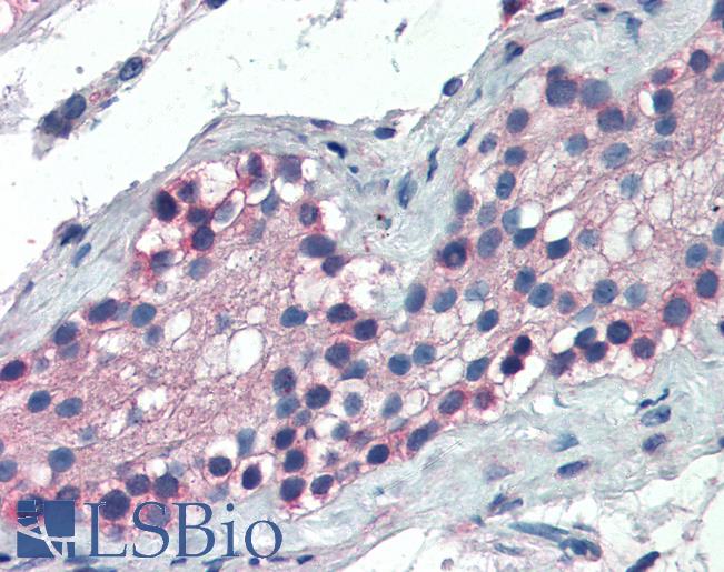 Anti-FOXE1 antibody IHC of human testis. Immunohistochemistry of formalin-fixed, paraffin-embedded tissue after heat-induced antigen retrieval. Antibody LS-B2492 concentration 5 ug/ml.
