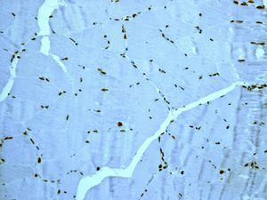 IHC of paraffin-embedded human muscle tissue using anti-FOXE1 antibody.