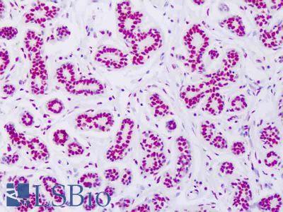 Anti-FOXE2 / FOXE1 antibody IHC of human breast. Immunohistochemistry of formalin-fixed, paraffin-embedded tissue after heat-induced antigen retrieval. Antibody LS-B8477concentration 5-10 ug/ml.
