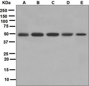 Western blot analysis on (A) human testis, (B) Caco-2, (C) HeLa, (D) TT and (E) BxPC-3 lysates using anti-FOXE1 antibody.