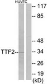 Western blot of extracts from HUVEC cells, using TTF2 Antibody. The lane on the right is treated with the synthesized peptide.