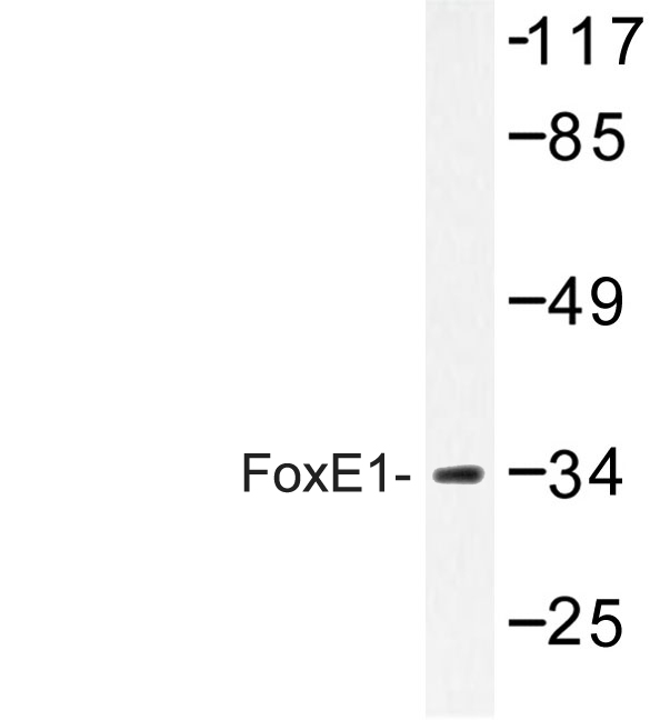 Western blot of FoxE1 (Q11) pAb in extracts from HUVEC cells.
