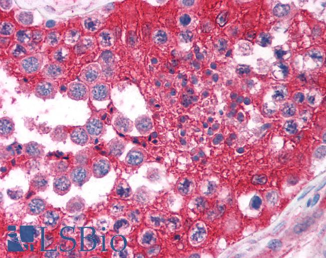 Anti-FOXE3 antibody IHC of human testis. Immunohistochemistry of formalin-fixed, paraffin-embedded tissue after heat-induced antigen retrieval. Antibody LS-B949 concentration 5 ug/ml.