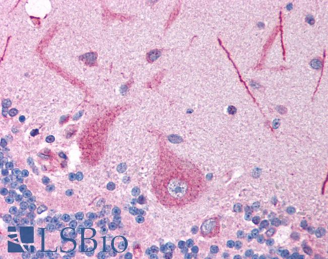 Anti-FOXE3 antibody IHC of human brain, cerebellum. Immunohistochemistry of formalin-fixed, paraffin-embedded tissue after heat-induced antigen retrieval. Antibody LS-B949 concentration 5 ug/ml.
