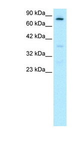 FOXE3 antibody LS-B949 Western blot of HepG2 cell lysate.