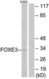 Western blot of extracts from K562 cells, using FOXE3 Antibody. The lane on the right is treated with the synthesized peptide.