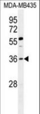 FOXE3 Antibody western blot of MDA-MB435 cell line lysates (35 ug/lane). The FOXE3 antibody detected the FOXE3 protein (arrow).