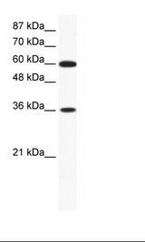 Jurkat Cell Lysate