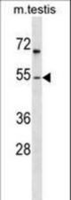 FOXF1 Antibody western blot of mouse testis tissue lysates (35 ug/lane). The FOXF1 antibody detected the FOXF1 protein (arrow).