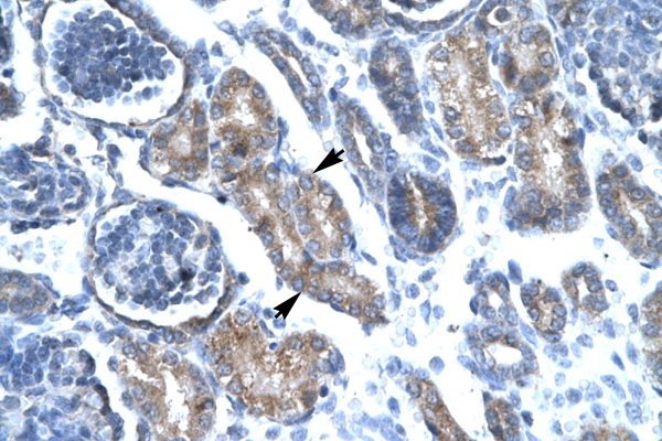FOXF1 antibody LS-C30852 IHC of formalin-fixed, paraffin-embedded human Kidney. Positive label: Epithelial cells of renal tubule indicated with arrows. Antibody concentration 4-8 ug/ml. Magnification 400X.