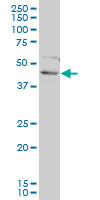 FOXF2 monoclonal antibody (M01), clone 2D7. Western Blot analysis of FOXF2 expression in H9c2(2-1).
