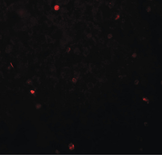 Immunofluorescence of FOXH1 in human liver tissue with FOXH1 antibody at 20 ug/ml.