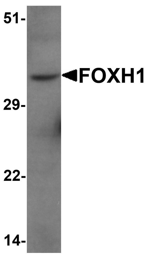 Western blot analysis of FOXH1 in human liver tissue lysate with FOXH1 antibody at 1 ug/ml.