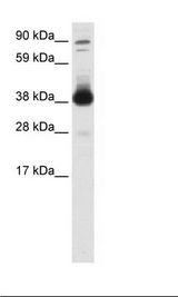 SP2/0 Cell Lysate