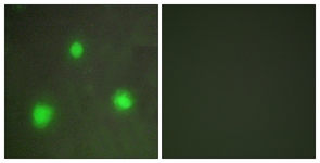 Immunofluorescence of A549 cells, using FOXH1 Antibody. The picture on the right is treated with the synthesized peptide.