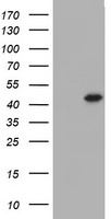 HEK293T cells were transfected with the pCMV6-ENTRY control (Left lane) or pCMV6-ENTRY FOXI1 (Right lane) cDNA for 48 hrs and lysed. Equivalent amounts of cell lysates (5 ug per lane) were separated by SDS-PAGE and immunoblotted with anti-FOXI1.