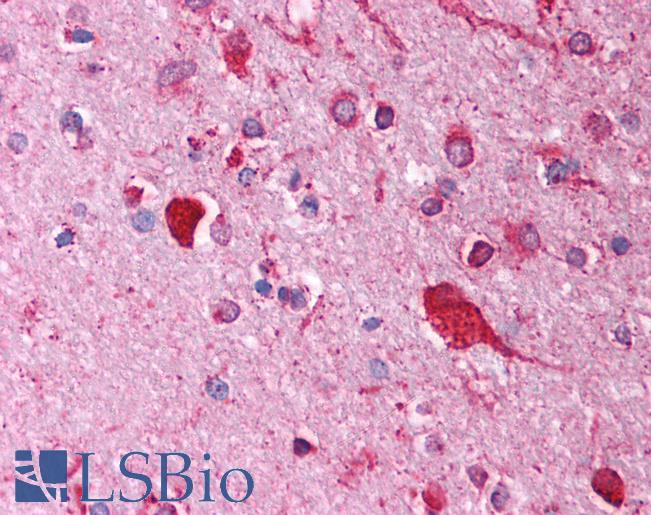 Anti-FOXI1 antibody IHC of human brain, cortex. Immunohistochemistry of formalin-fixed, paraffin-embedded tissue after heat-induced antigen retrieval. Antibody LS-B950 concentration 5 ug/ml.