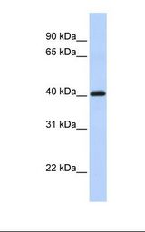 Fetal heart lysate. Antibody concentration: 1.0 ug/ml. Gel concentration: 12%.