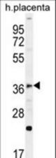 FOXI1 Antibody western blot of human placenta tissue lysates (35 ug/lane). The FOXI1 antibody detected the FOXI1 protein (arrow).