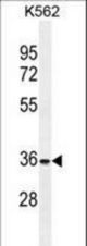 FOXI3 Antibody western blot of K562 cell line lysates (35 ug/lane). The FOXI3 antibody detected the FOXI3 protein (arrow).