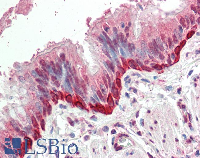 Huhuman Bronchus: Formalin-Fixed, Paraffin-Embedded (FFPE)