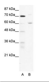 A: Marker, B: HepG2 Cell Lysate