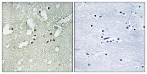 IHC of paraffin-embedded human brain tissue, using FOXJ3 Antibody. The picture on the right is treated with the synthesized peptide.