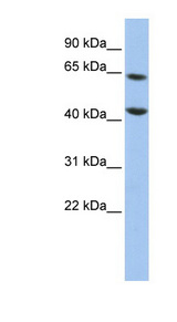 FOXJ3 antibody LS-C101383 Western blot of HepG2 cell lysate.
