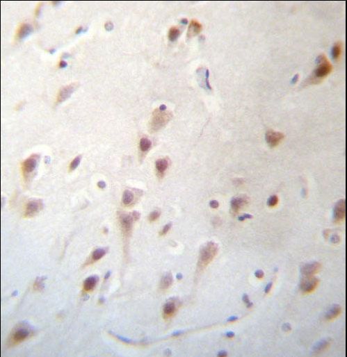 FOXJ3 Antibody immunohistochemistry of formalin-fixed and paraffin-embedded human brain tissue followed by peroxidase-conjugated secondary antibody and DAB staining.