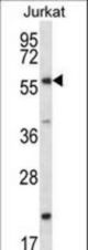 FOXJ3 Antibody western blot of Jurkat cell line lysates (35 ug/lane). The FOXJ3 antibody detected the FOXJ3 protein (arrow).