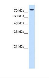 HepG2 cell lysate. Antibody concentration: 0.25 ug/ml. Gel concentration: 12%.