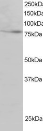 Antibody staining (2 ug/ml) of Human Heart lysate (RIPA buffer, 30 ug total protein per lane). Primary incubated for 1 hour. Detected by Western blot of chemiluminescence.