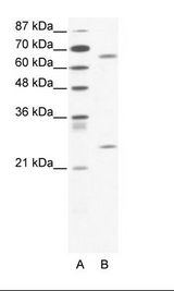 A: Marker, B: Jurkat Cell Lysate