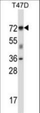 FOXK2 Antibody western blot of T47D cell line lysates (35 ug/lane). The FOXK2 antibody detected the FOXK2 protein (arrow).