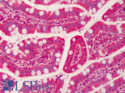 Anti-FOXK2 antibody IHC of human small intestine. Immunohistochemistry of formalin-fixed, paraffin-embedded tissue after heat-induced antigen retrieval. Antibody LS-B1529 concentration 5 ug/ml.