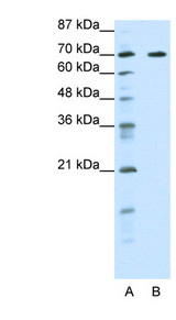 FOXK2 antibody LS-B1529 Western blot of HepG2 cell lysate.