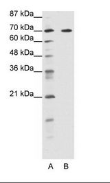 A: Marker, B: HepG2 Cell Lysate