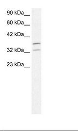 Fetal Liver Lysate