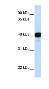 FOXL1 antibody LS-C102732 Western blot of Fetal Heart lysate.