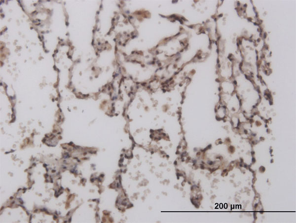Immunoperoxidase of monoclonal antibody to FOXL1 on formalin-fixed paraffin-embedded human lung. [antibody concentration 3 ug/ml]