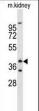 Western blot of FOXL1 Antibody in mouse kidney tissue lysates (35 ug/lane). FOXL1 (arrow) was detected using the purified antibody.