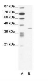 A: Marker, B: Jurkat Cell Lysate