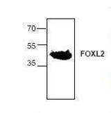 Western blot of FOXL2 antibody LS-C48665.