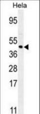 FOXL2 Antibody western blot of HeLa cell line lysates (35 ug/lane). The FOXL2 antibody detected the FOXL2 protein (arrow).