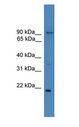 FOXM1 antibody Western Blot of THP-1 cell lysate.