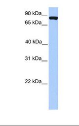 Fetal liver lysate. Antibody concentration: 1.0 ug/ml. Gel concentration: 12%.