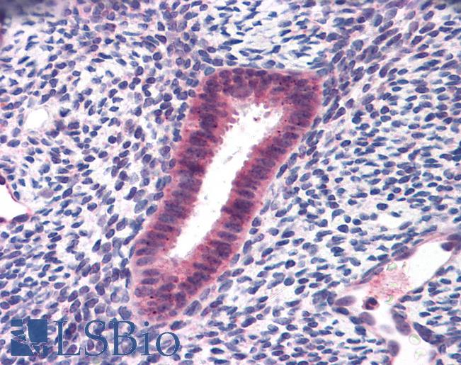 Anti-FOXN1 antibody IHC of human uterus. Immunohistochemistry of formalin-fixed, paraffin-embedded tissue after heat-induced antigen retrieval. Antibody LS-B4832 concentration 10 ug/ml.